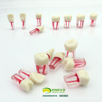 VENDER 12577 Diente de Endodoncia Canal Endodoncia Manchado Modelo 8pcs / set Endo dientes